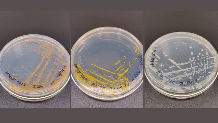 a collage of 3 petri dishes with bacteria on them