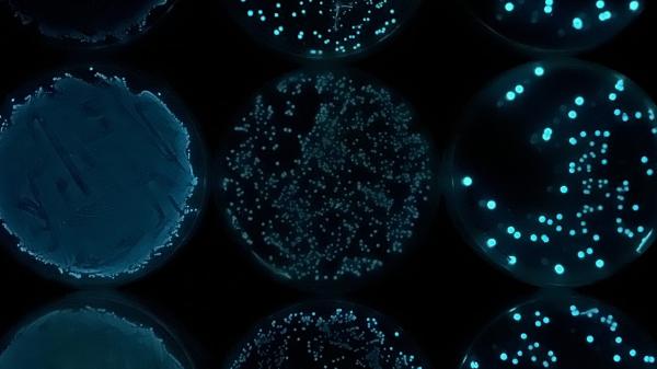 A close up of bacterial cultures captured under the microscope